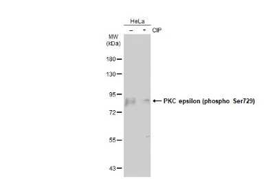 <b>Biological Strategies Validation. </b>Western Blot: PKC epsilon [p Ser729] Antibody [NBP3-13312] - Untreated (-) and treated (+) HeLa whole cell extracts (30 ug) were separated by 7.5% SDS-PAGE, and the membrane was blotted with PKC epsilon (phospho Ser729) antibody (NBP3-13312) diluted at 1:1000. The HRP-conjugated anti-rabbit IgG antibody (NBP2-19301) was used to detect the primary antibody, and the signal was developed with Trident ECL plus-Enhanced.